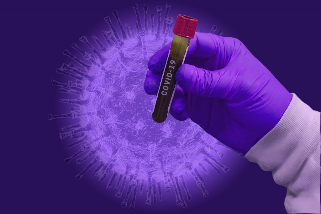 Edison new COVID-19 cases remain in double digits