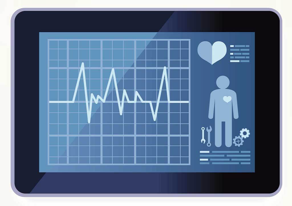 Launching full-court press against sudden cardiac death in young athletes