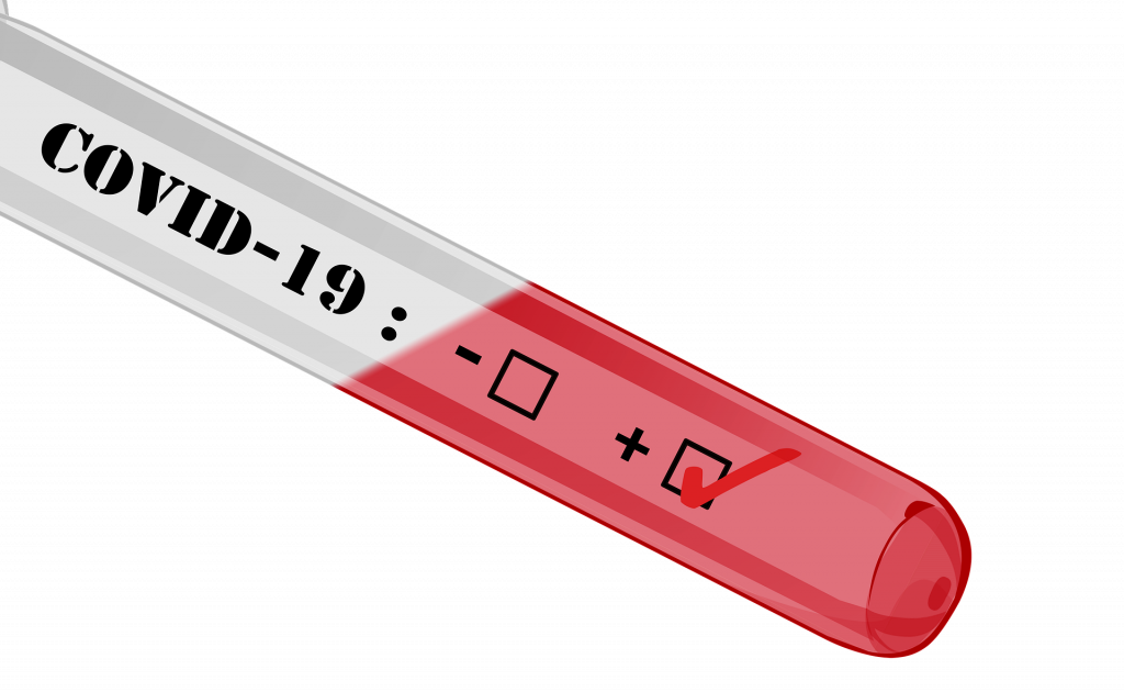 Edison new COVID-19 cases under 10